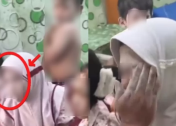 Belasan siswa SDN Bira Tengah 1, Kecamatan Sokobanah, Kabupaten Sampang, Madura, dilaporkan mengalami reaksi alergi kulit secara mendadak pada Rabu (22/4/2026).